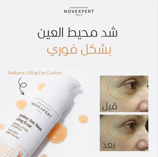 كريم نوفإكسبيرت لشد وإشراق محيط العين بفيتامين C - طبيعي 100%Novexpert Radiance Lifting Eye Contour - 100% Natural Vitamin C